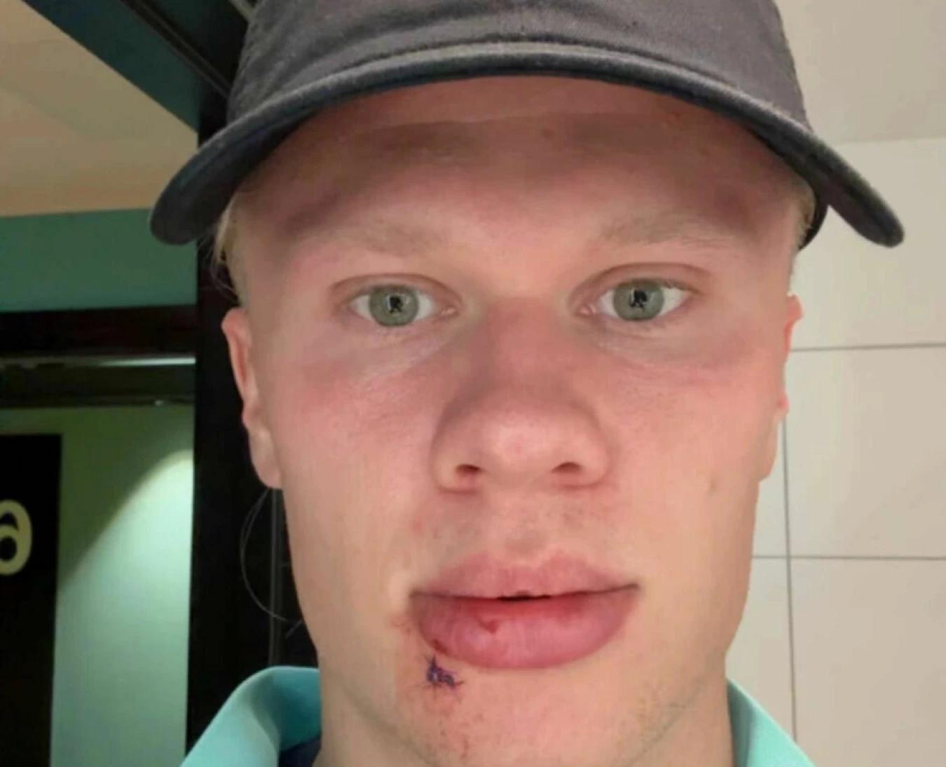 很靠前, 的伤情, http 很靠前, 的伤情, http